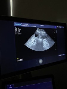 ultrazvuk---vysetreni-brezosti.jpg